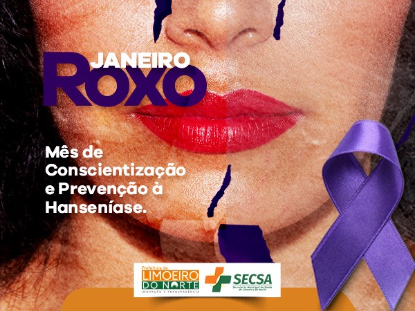 Janeiro Roxo alerta para a conscientização sobre a hanseníase